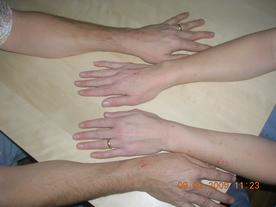 Brun Family  - Image Name: Damage_2145